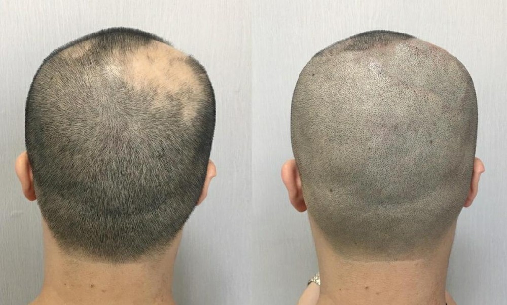 兰州华医皮肤病医院